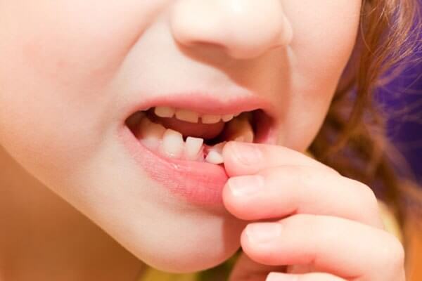 სიზმარში კბილების ამოვარდნის ინტერპრეტაცია