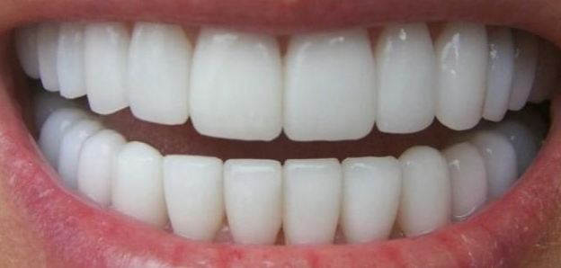 სიზმარში კბილების ნახვის ინტერპრეტაცია