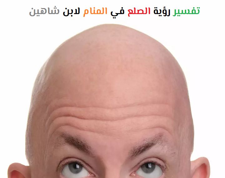 Baldness an engem Dram vum Ibn Shaheen
