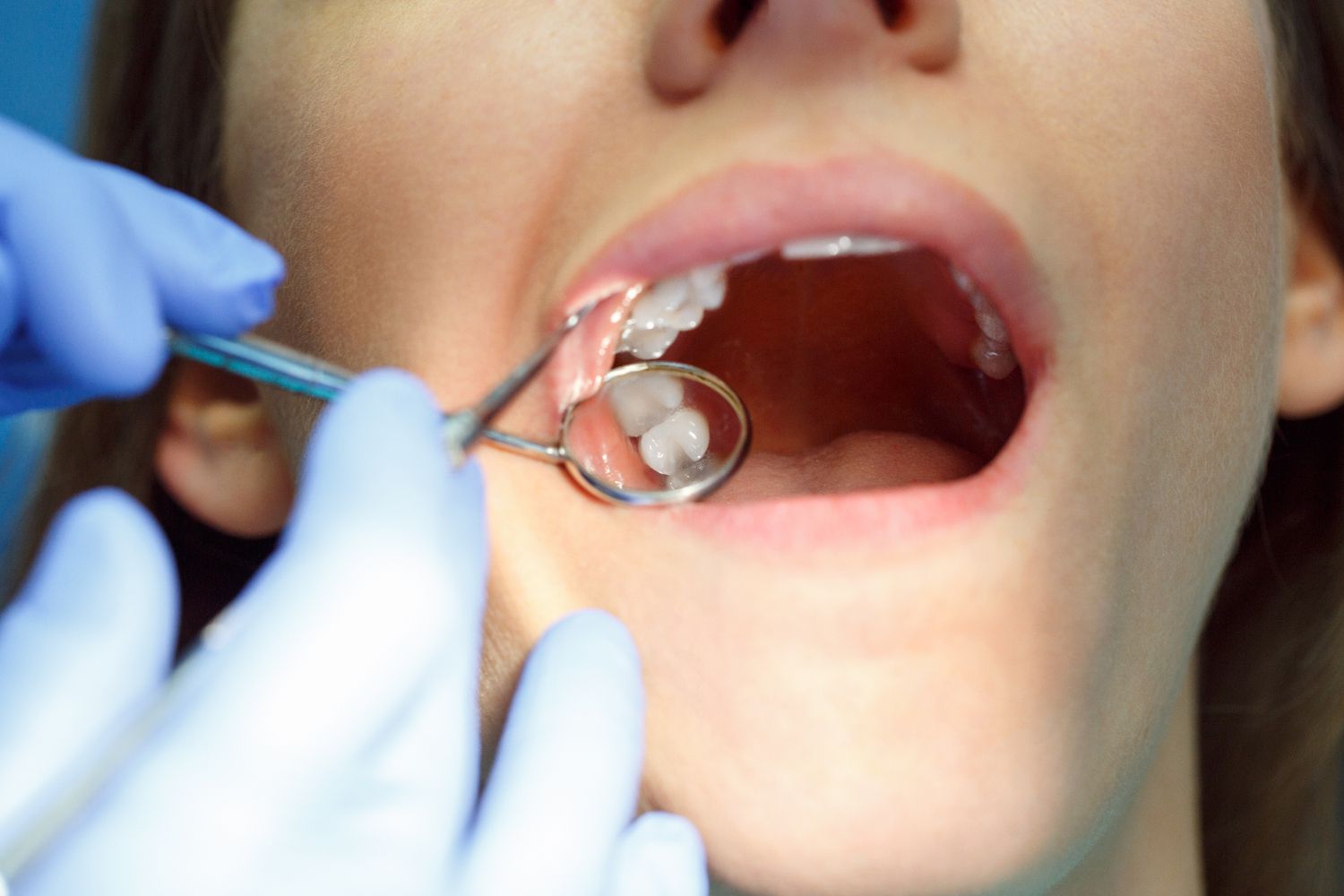 Толкување на сонот за кршење на заб