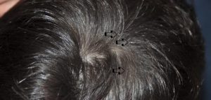 Emakume ezkondu baten ilean gurutzeari buruzko amets baten interpretazioa