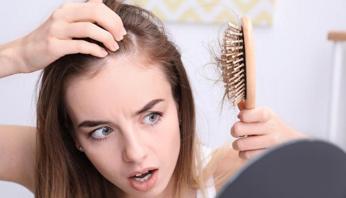 Tulkinta unesta hiustenlähtöstä ja kaljuuntumisesta