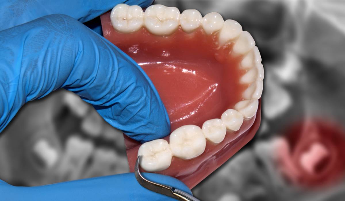 Interpretatie van een droom over het trekken van tanden bij de dokter