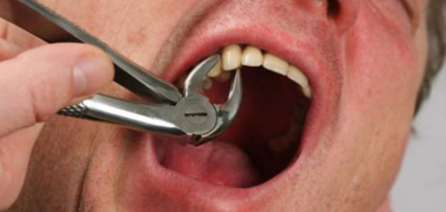 სიზმარში კბილის ამოღების ნახვა
