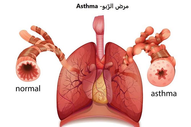 Astma einkenni