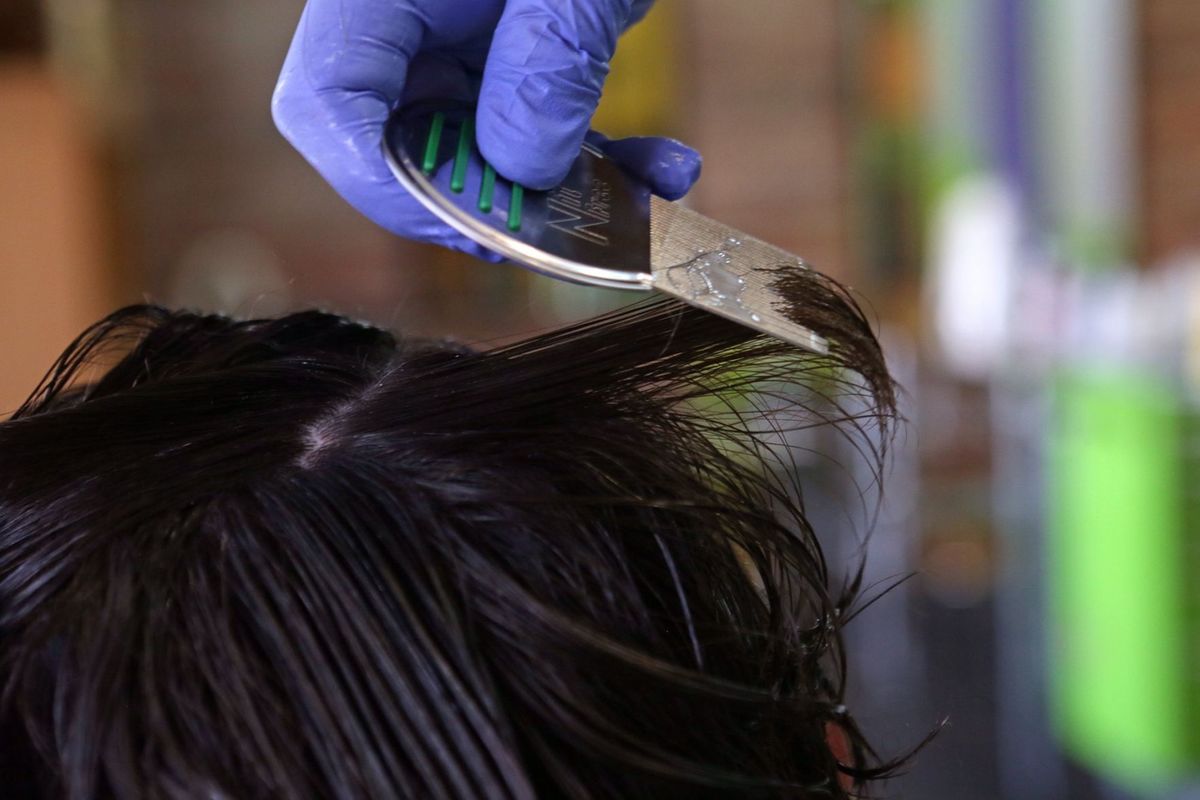 Тумачење снова о вашкама у коси и њиховом убијању