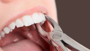 خلع الضرس في المنام