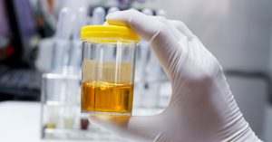 تفسير حلم البول وفيه دم