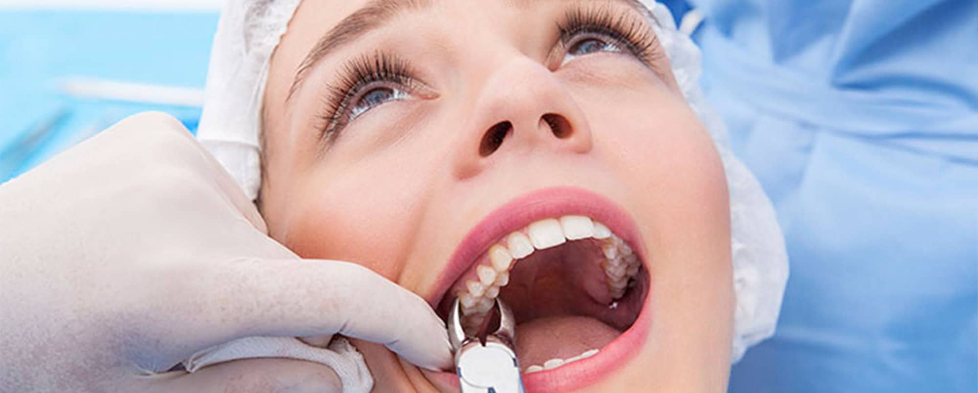 Interpretasi pencabutan gigi dalam mimpi
