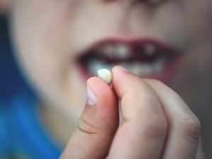 سقوط الناب في المنام للعزباء