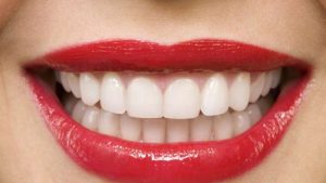 الأسنان في الحلم