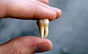 تفسير سقوط الناب العلوي الايسر في المنام