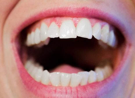 تفسير رؤية الأسنان في المنام وبالأخص سقوطها