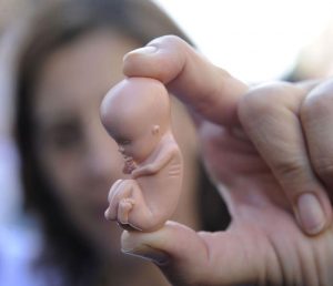 تفسير حلم الإجهاض للمتزوجة الغير حامل