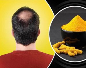 تعرف على فوائد الكركم للشعر