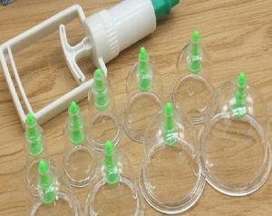 تعرفي على فوائد الحجامة للنساء