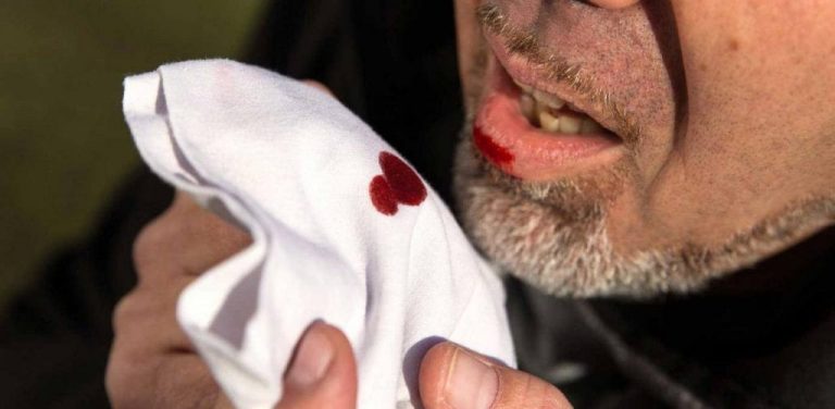 تفسير حلم خروج كتل دم من الفم