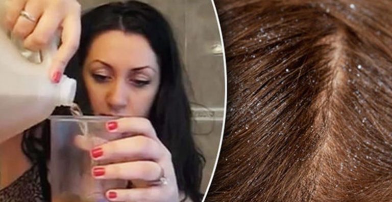 فوائد خل التفاح للشعر