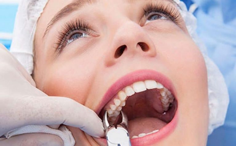 خلع الاسنان في المنام