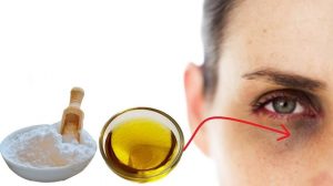 فائدة زيت جنين القمح للهالات