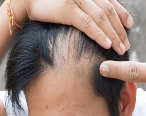 كيفية استخدام زيت الخروع