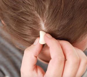 فوائد الثوم للشعر