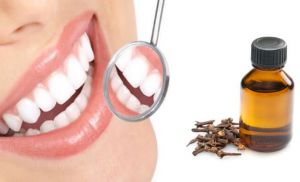 فوائد القرنفل للأسنان